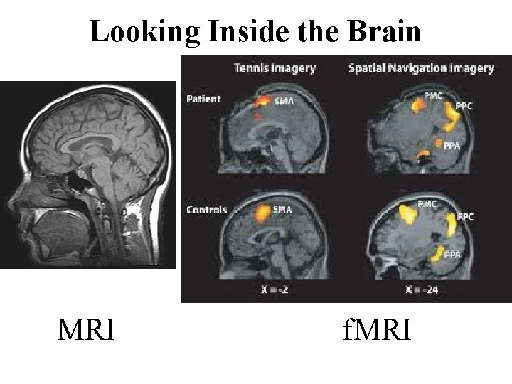 Looking Inside the Brain MRI f. MRI 