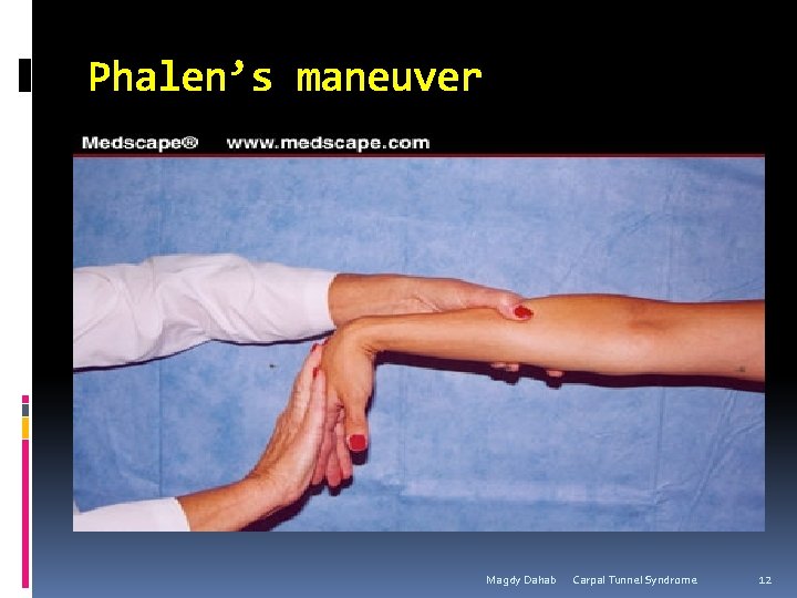 Phalen’s maneuver Magdy Dahab Carpal Tunnel Syndrome 12 