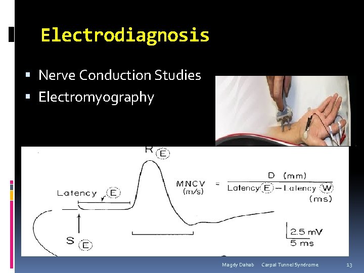 Electrodiagnosis Nerve Conduction Studies Electromyography Magdy Dahab Carpal Tunnel Syndrome 13 