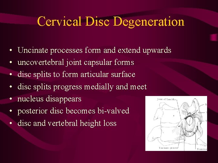 Cervical Disc Degeneration • • Uncinate processes form and extend upwards uncovertebral joint capsular