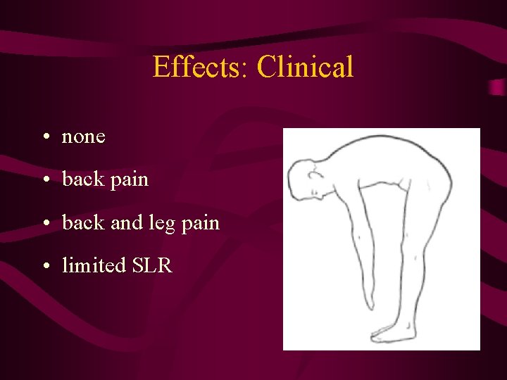 Effects: Clinical • none • back pain • back and leg pain • limited