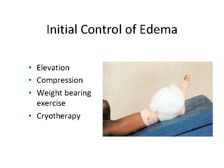 Initial Control of Edema • Elevation • Compression • Weight bearing exercise • Cryotherapy