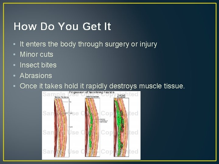 How Do You Get It • • • It enters the body through surgery