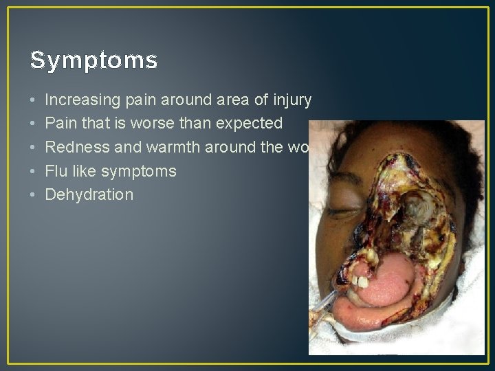 Symptoms • • • Increasing pain around area of injury Pain that is worse