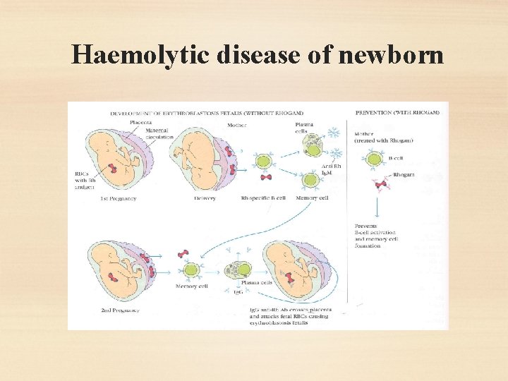 Haemolytic disease of newborn 