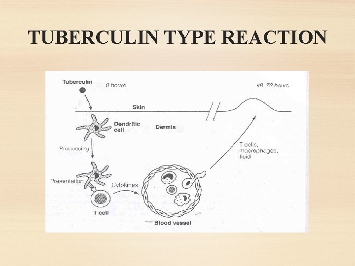 TUBERCULIN TYPE REACTION 