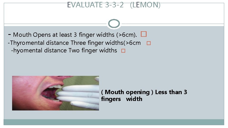 EVALUATE 3 -3 -2 (LEMON) - Mouth Opens at least 3 finger widths (>6