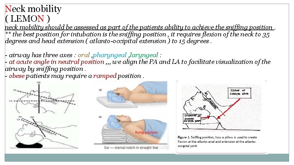 Neck mobility ( LEMON ) neck mobility should be assessed as part of the
