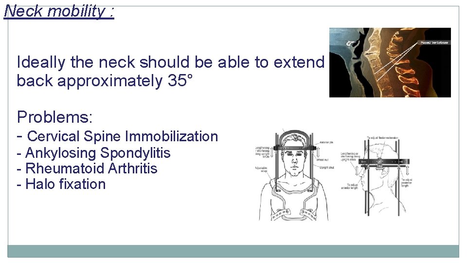 Neck mobility : Ideally the neck should be able to extend back approximately 35°