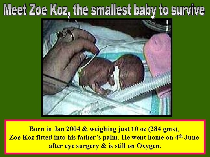 Born in Jan 2004 & weighing just 10 oz (284 gms), Zoe Koz fitted