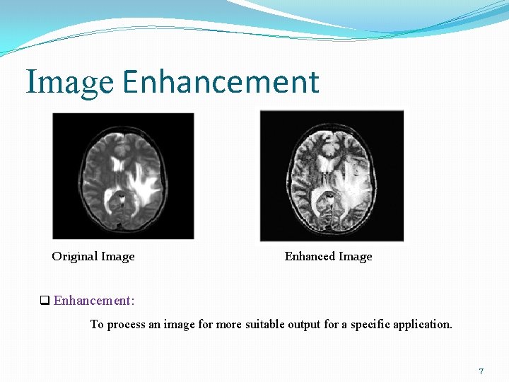 Image Enhancement Original Image Enhanced Image q Enhancement: To process an image for more