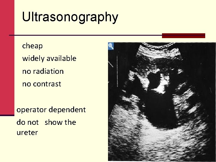 Ultrasonography cheap widely available no radiation no contrast operator dependent do not show the