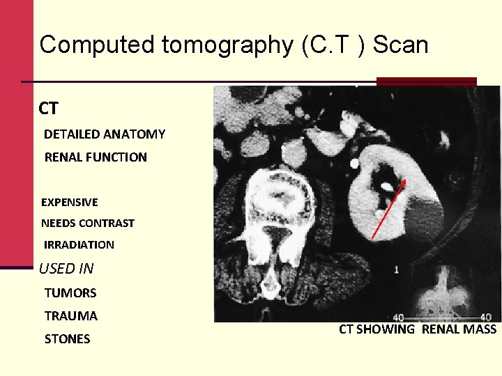 Computed tomography (C. T ) Scan CT DETAILED ANATOMY RENAL FUNCTION EXPENSIVE NEEDS CONTRAST