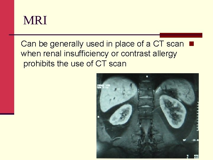 MRI Can be generally used in place of a CT scan n when renal