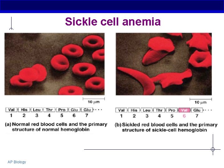 Sickle cell anemia AP Biology 