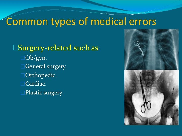 Common types of medical errors �Surgery-related such as: �Ob/gyn. �General surgery. �Orthopedic. �Cardiac. �Plastic