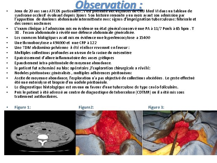  • • • • Observation : Jeun de 20 ans sans ATCDS particuliers