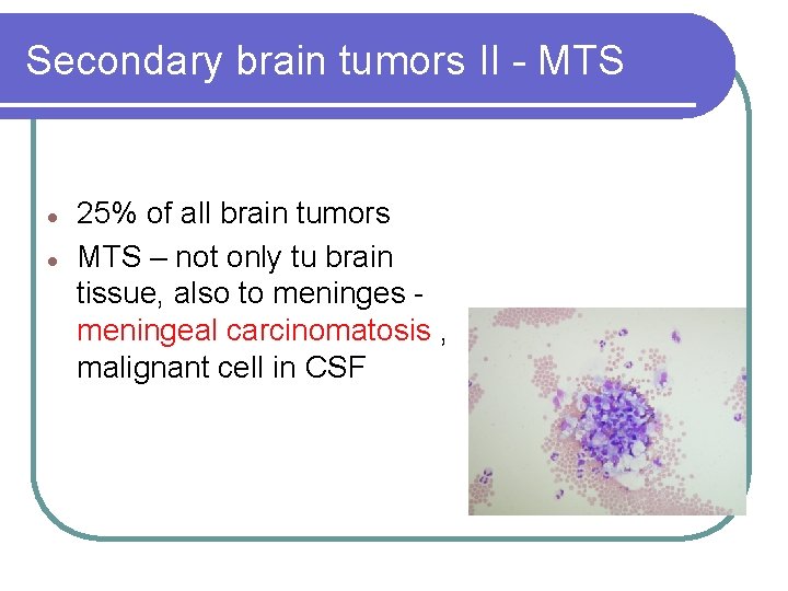 Secondary brain tumors II - MTS l l 25% of all brain tumors MTS