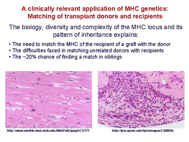 A clinically relevant application of MHC genetics: Matching of transplant donors and recipients The