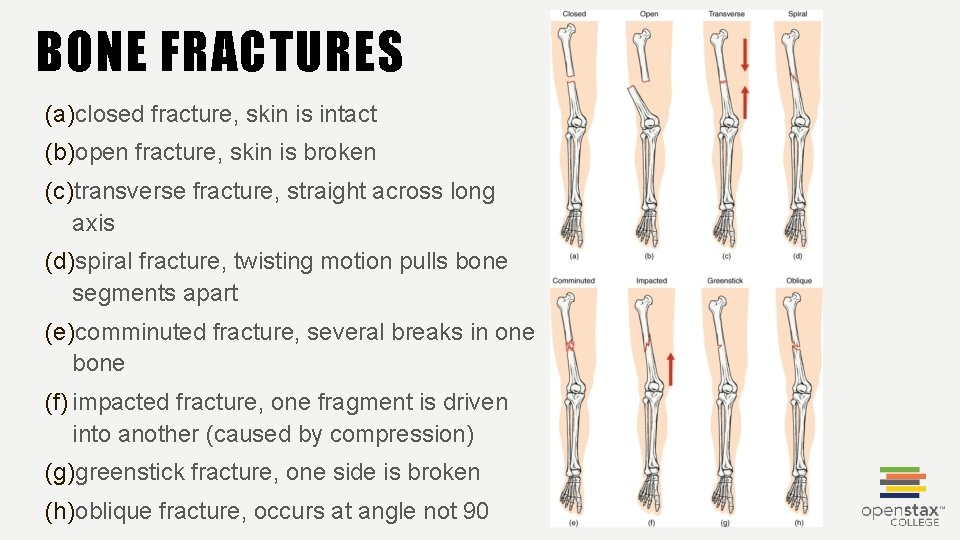 BONE FRACTURES (a)closed fracture, skin is intact (b)open fracture, skin is broken (c)transverse fracture,