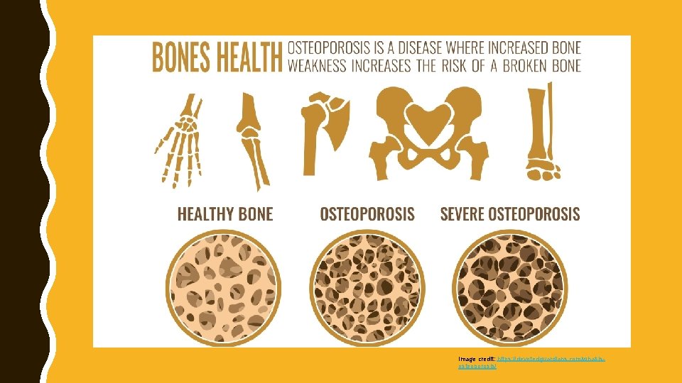 Image credit: https: //devotedguardians. com/what-isosteoporosis/ 