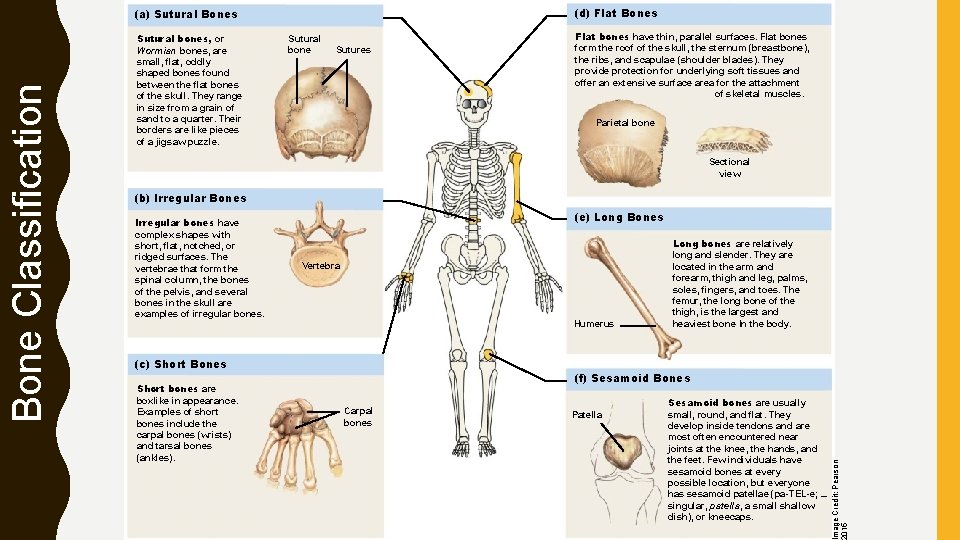 (d) Flat Bones Sutural bones, or Wormian bones, are small, flat, oddly shaped bones