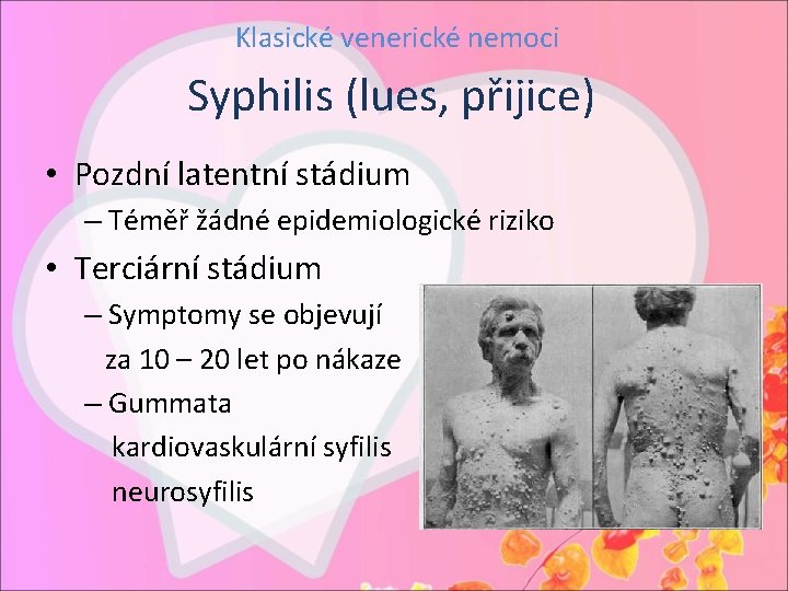 Klasické venerické nemoci Syphilis (lues, přijice) • Pozdní latentní stádium – Téměř žádné epidemiologické