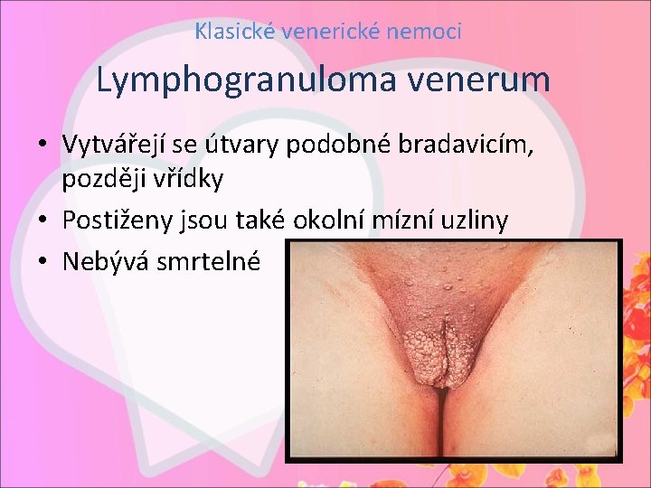 Klasické venerické nemoci Lymphogranuloma venerum • Vytvářejí se útvary podobné bradavicím, později vřídky •