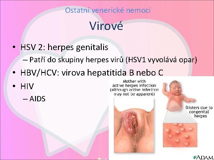 Ostatní venerické nemoci Virové • HSV 2: herpes genitalis – Patří do skupiny herpes