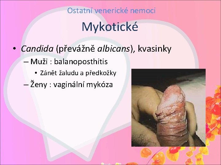 Ostatní venerické nemoci Mykotické • Candida (převážně albicans), kvasinky – Muži : balanoposthitis •