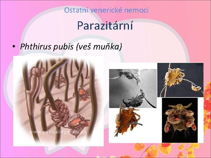 Ostatní venerické nemoci Parazitární • Phthirus pubis (veš muňka) 