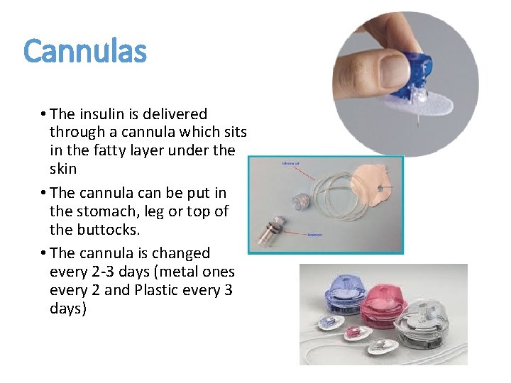 Cannulas • The insulin is delivered through a cannula which sits in the fatty
