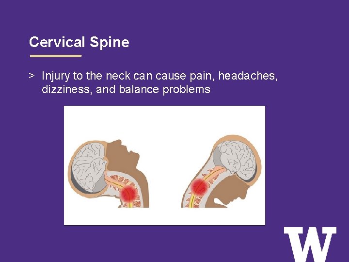 Cervical Spine > Injury to the neck can cause pain, headaches, dizziness, and balance