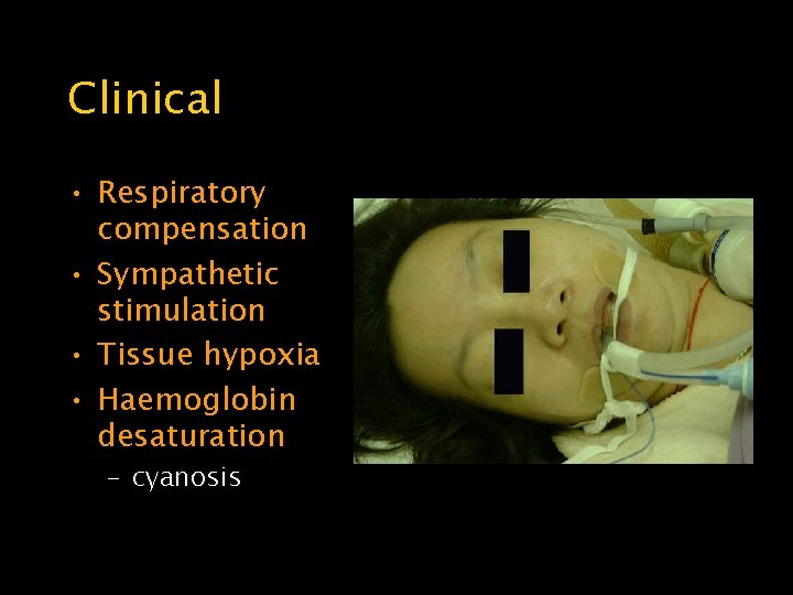 Clinical • Respiratory compensation • Sympathetic stimulation • Tissue hypoxia • Haemoglobin desaturation –