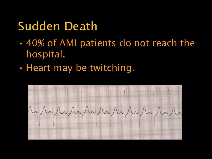 Sudden Death • 40% of AMI patients do not reach the hospital. • Heart