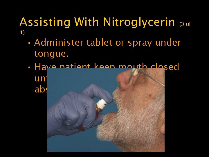 Assisting With Nitroglycerin 4) (3 of • Administer tablet or spray under tongue. •