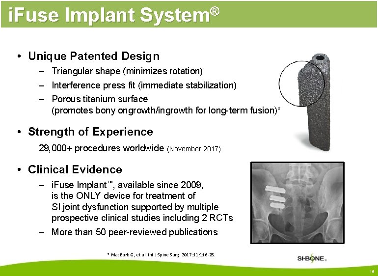 i. Fuse Implant System® • Unique Patented Design – Triangular shape (minimizes rotation) –