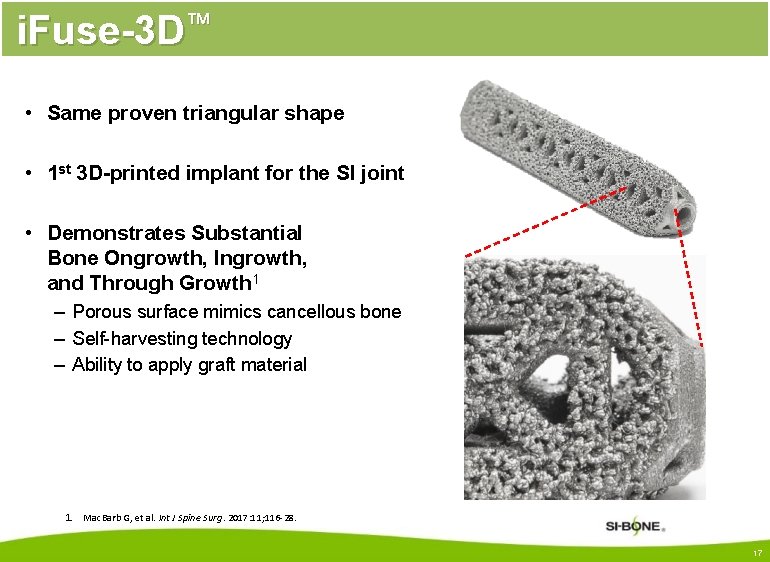 i. Fuse-3 D™ • Same proven triangular shape • 1 st 3 D-printed implant