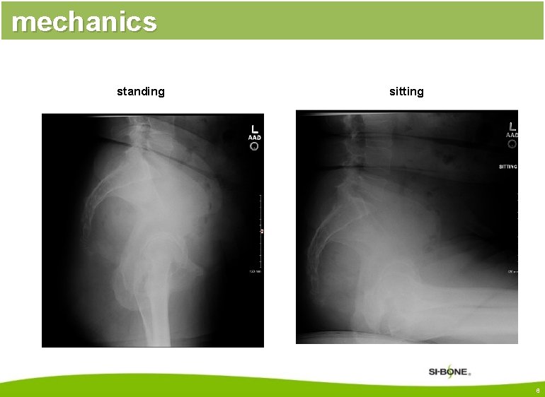 mechanics standing sitting 6 