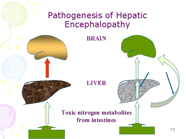Pathogenesis of Hepatic Encephalopathy BRAIN LIVER Toxic nitrogen metabolites from intestines 73 