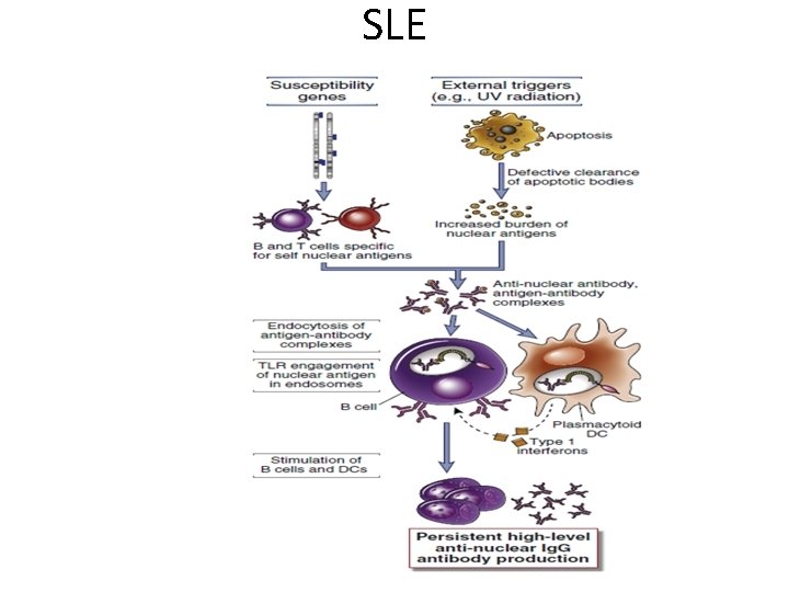 SLE 