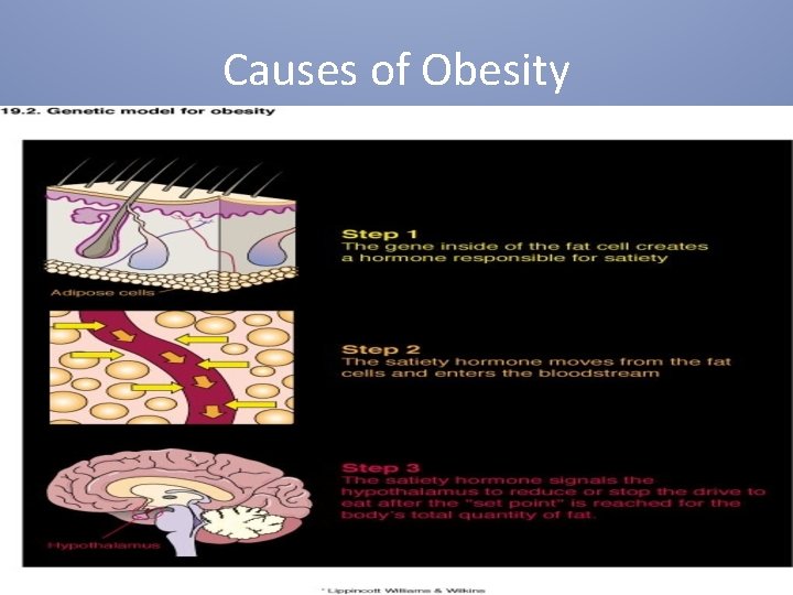 Causes of Obesity 