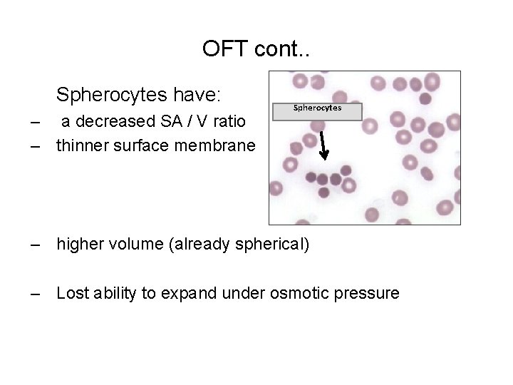 OFT cont. . Spherocytes have: – a decreased SA / V ratio – thinner