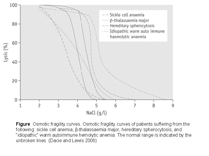 Figure Osmotic fragility curves of patients suffering from the following: sickle cell anemia, β-thalassaemia