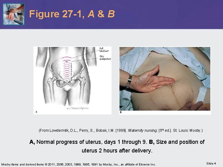 Figure 27 -1, A & B (From Lowdermilk, D. L. , Perry, S. ,