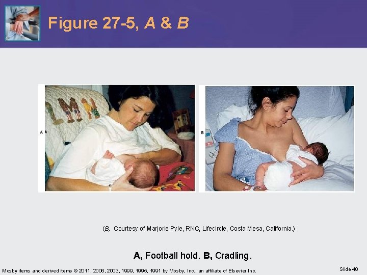 Figure 27 -5, A & B (B, Courtesy of Marjorie Pyle, RNC, Lifecircle, Costa