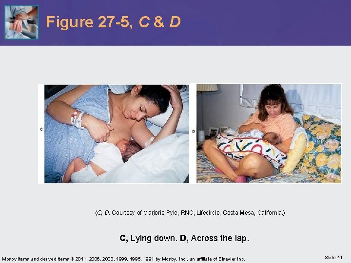 Figure 27 -5, C & D (C, D, Courtesy of Marjorie Pyle, RNC, Lifecircle,