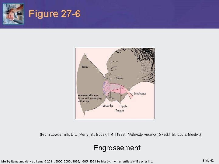 Figure 27 -6 (From Lowdermilk, D. L. , Perry, S. , Bobak, I. M.