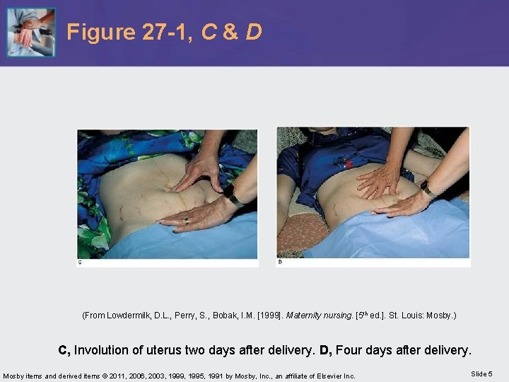 Figure 27 -1, C & D (From Lowdermilk, D. L. , Perry, S. ,