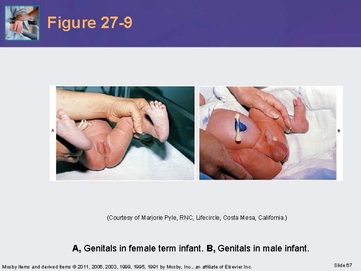 Figure 27 -9 (Courtesy of Marjorie Pyle, RNC, Lifecircle, Costa Mesa, California. ) A,